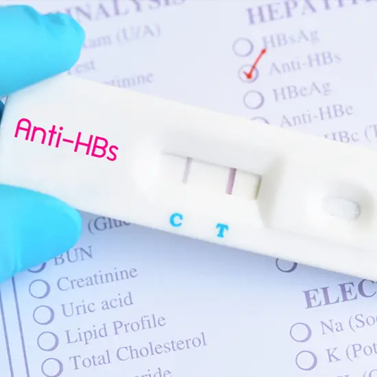 Hepatitis Bs (Surface) Antigen (HBsAg) Test